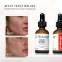 Dr Sebagh Exo C Booster – before and after results