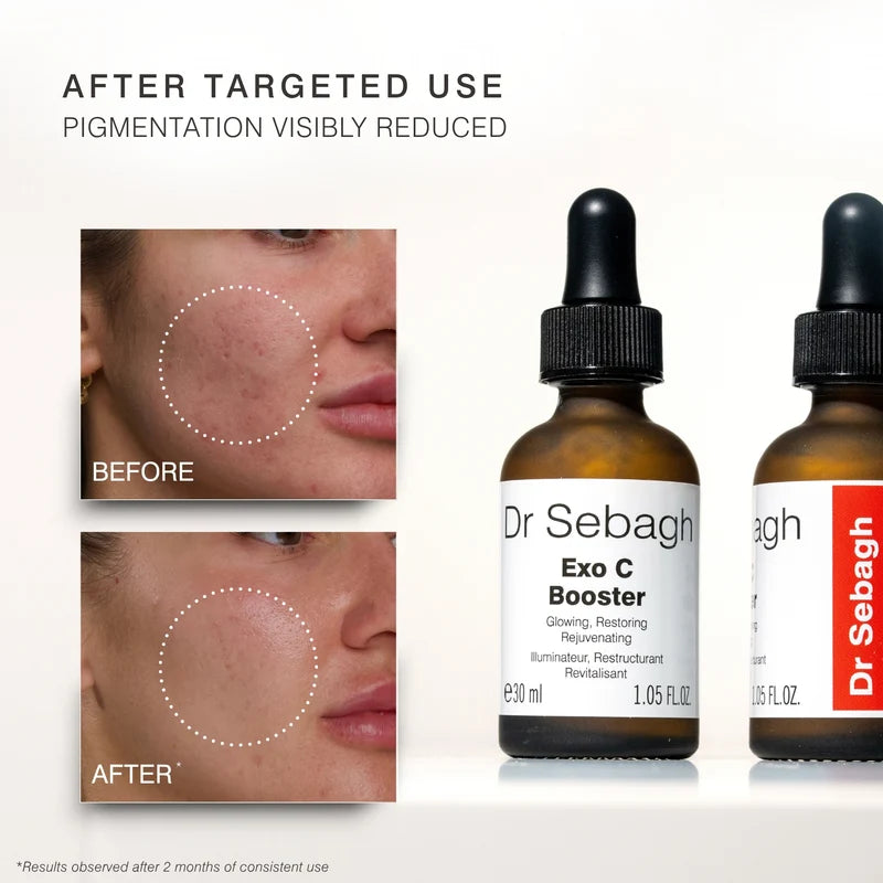 Dr Sebagh Exo C Booster – before and after results