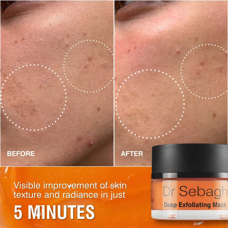 Dr Sebagh Deep Exfoliating Mask – before and after results