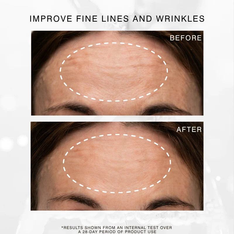Dr Sebagh Exo C Booster – before and after results (2)