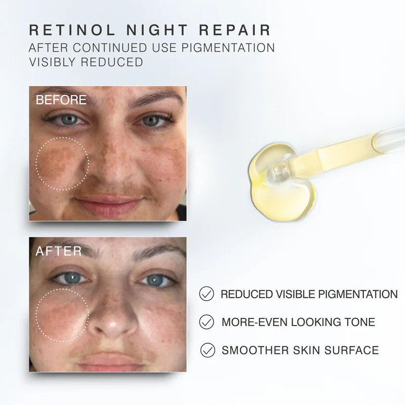 Dr Sebagh Retinol Night Repair – lifestyle image