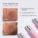Dr Sebagh Rose de Vie Serum – before and after results
