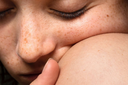 Sensitive Skin