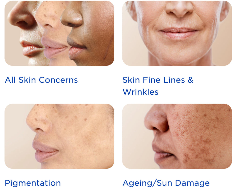 Microneedling - Too Good to Be Truth