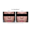Advanced Nutrition Programme Skin Clear Biome™ – product image 4
