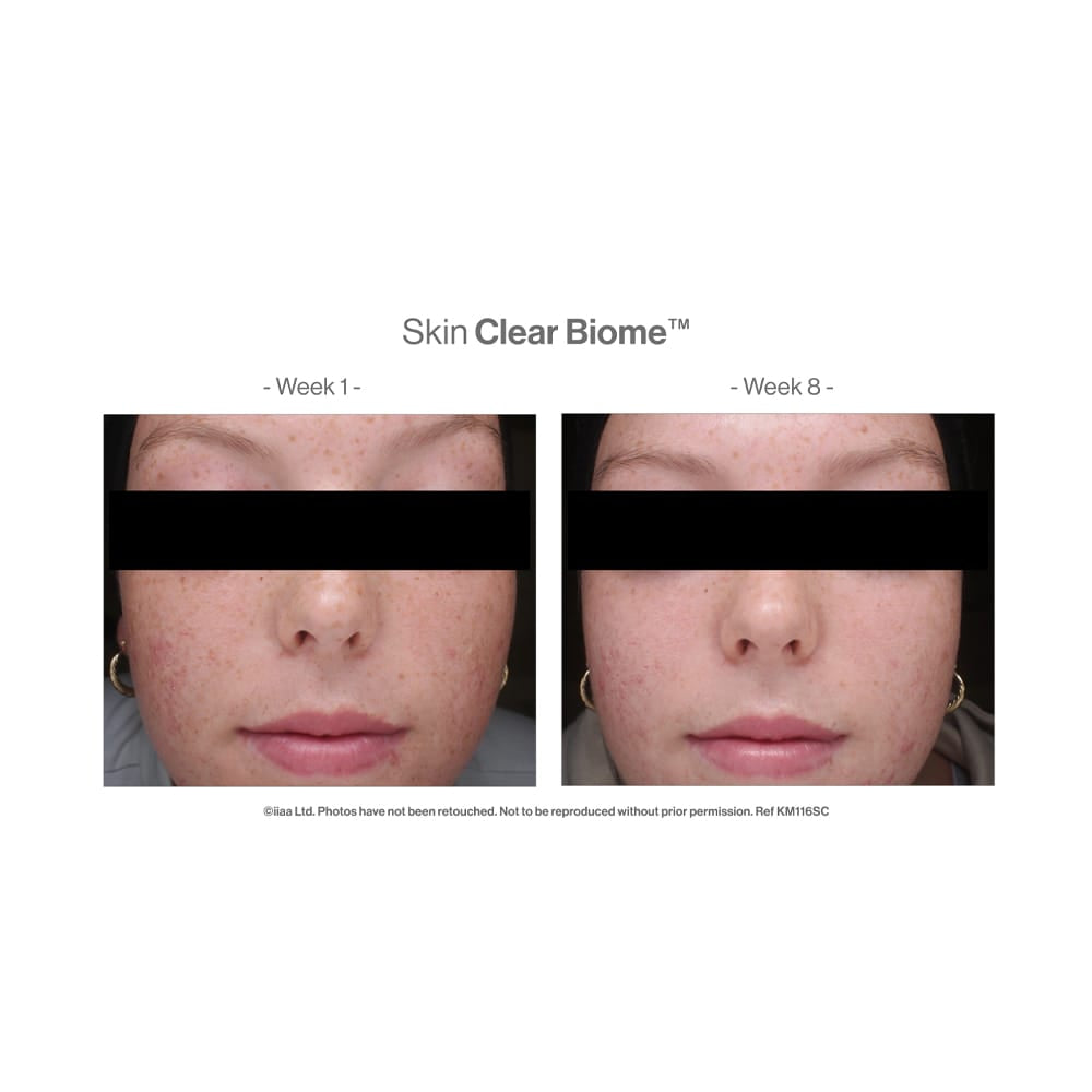 Skin Clear Biome™