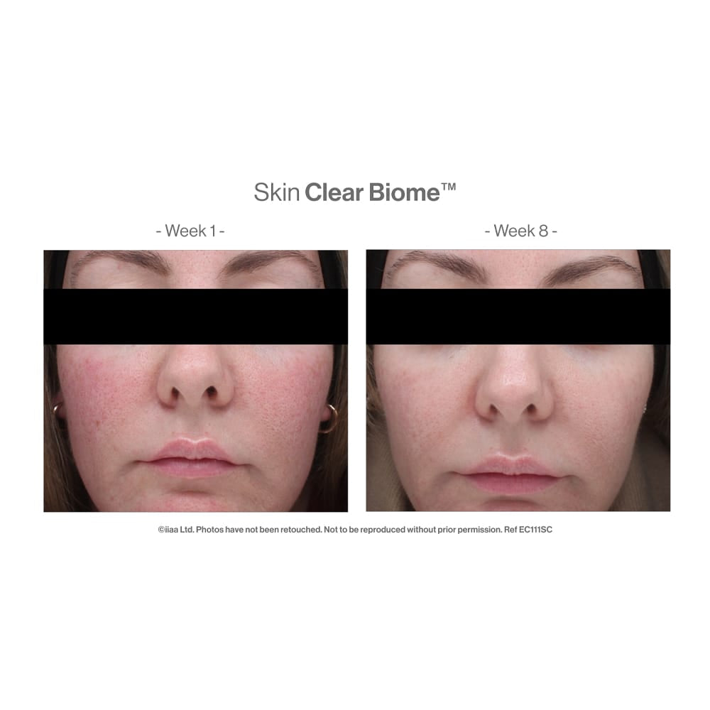 Skin Youth Biome™