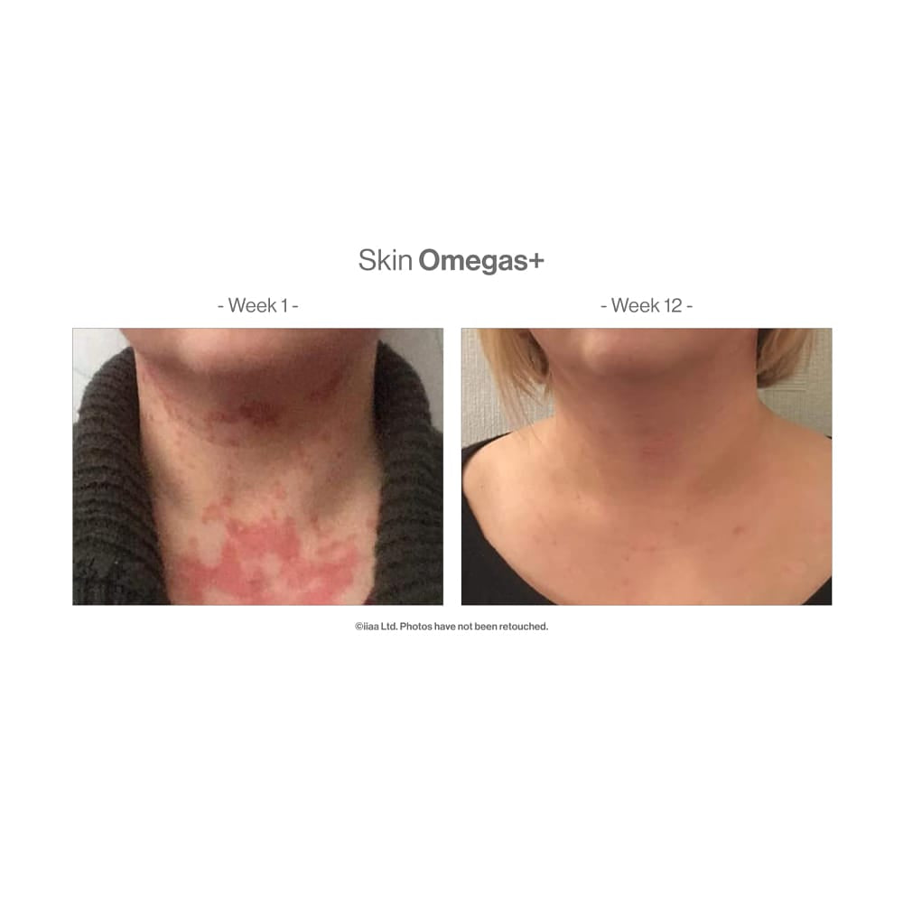 Skin Omegas+