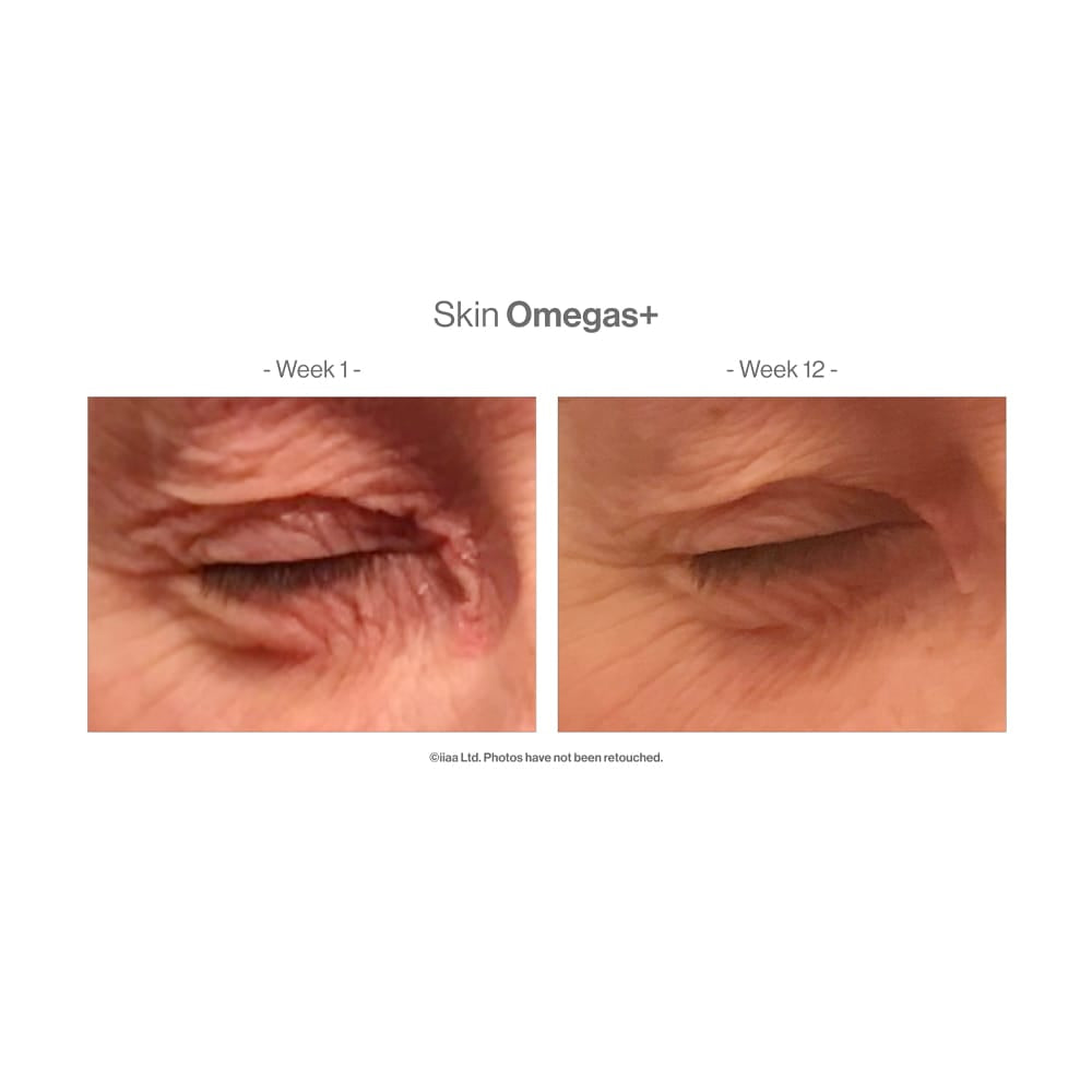 Skin Omegas+